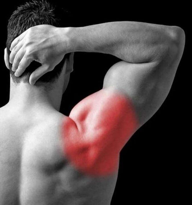 Schmerzen im Schulter- und Hinterkopfbereich bei zervikaler Osteochondrose