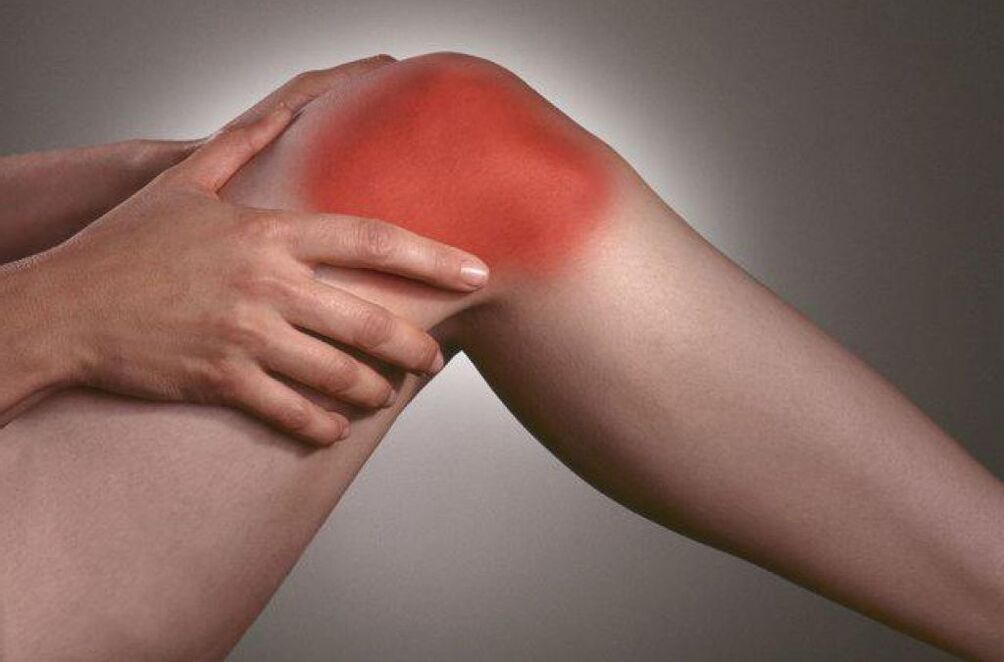 Knieschmerzen durch Arthrose
