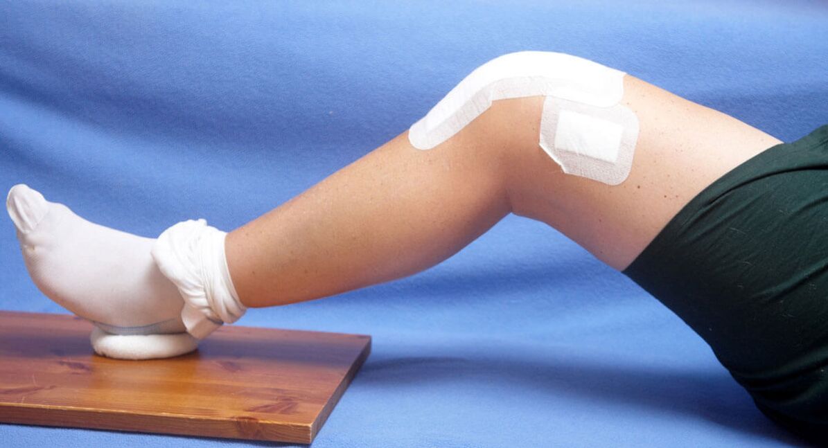 Knieverletzung als Ursache für Arthrose