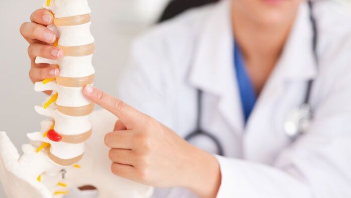 Erklärung der lumbalen Osteochondrose am Wirbelsäulenmodell